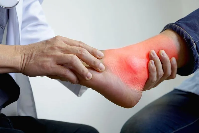 Bệnh khớp Charcot: Nguyên nhân, triệu chứng và phương pháp điều trị