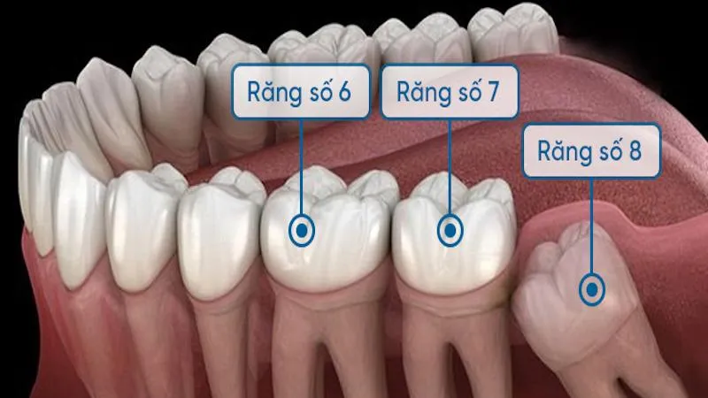 Bị mất răng số 7 hàm dưới có nguy hiểm đến sức khỏe hay không?