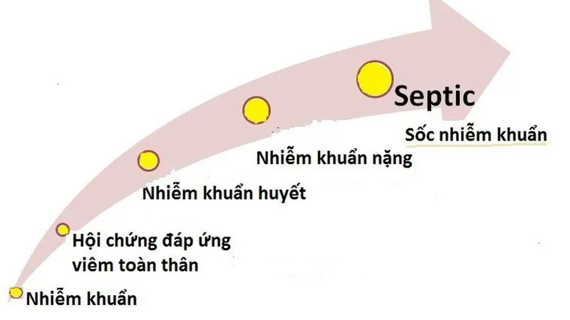 Các phương pháp chẩn đoán sốc nhiễm khuẩn và cách điều trị bệnh