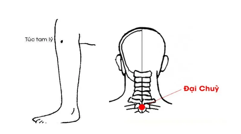 Cách bấm huyệt chữa bệnh trĩ hiệu quả