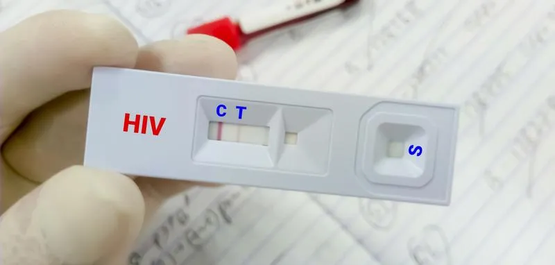 Cách đọc kết quả xét nghiệm HIV cực dễ dàng và chính xác