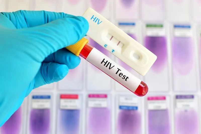 Cách phòng tránh HIV cho mình và cho cộng đồng