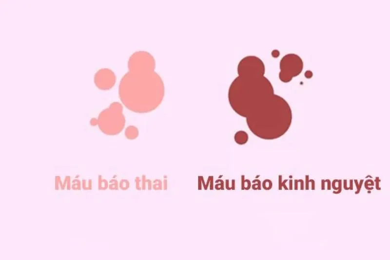 Cơ thể mệt mỏi buồn ngủ có phải có thai không? Một số dấu hiệu mang thai