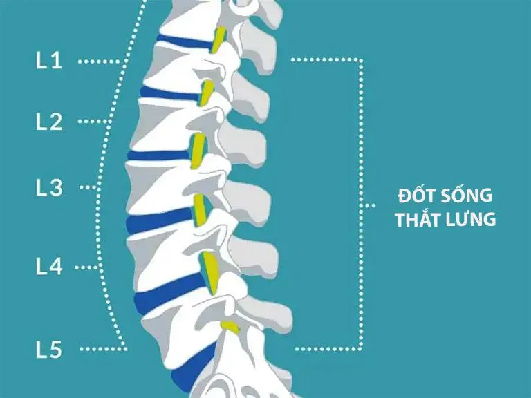 Dị tật gai đôi cột sống L5 là gì? Phát hiện và điều trị như thế nào?