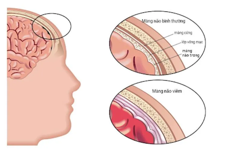 Dịch não tuỷ và những thông tin cần biết