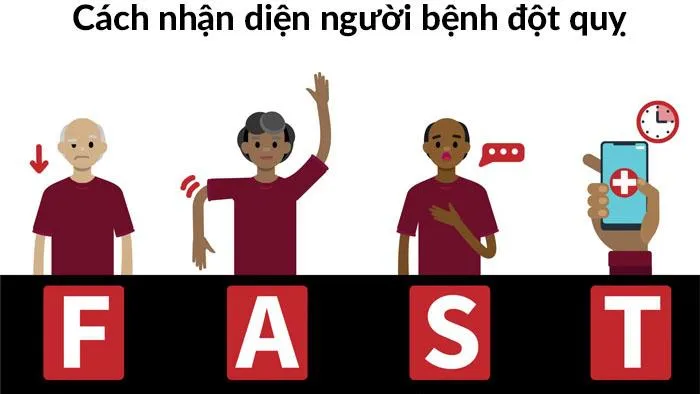 FAST đột quỵ: Dấu hiệu nhận biết sớm và cách xử lý