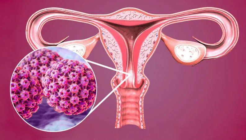 Giá tiêm HPV hiện nay là bao nhiêu?