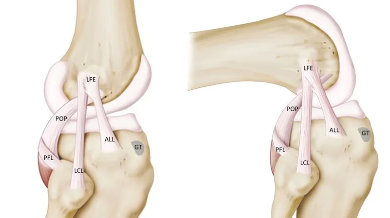 Giá trị chẩn đoán, định hướng điều trị và quy trình chụp MRI dây chằng mà bạn nên biết