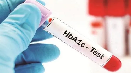 Giải đáp: Xét nghiệm HbA1c có cần nhịn ăn?