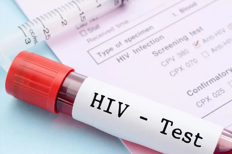 Hiểu rõ các phương pháp xét nghiệm HIV: Kiến thức quan trọng về sức khỏe cần nắm!