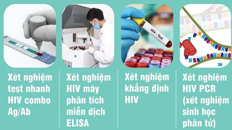 Hiểu rõ các phương pháp xét nghiệm HIV: Kiến thức quan trọng về sức khỏe cần nắm!