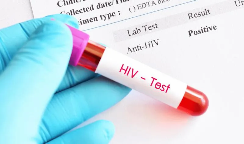 Hiểu rõ các phương pháp xét nghiệm HIV: Kiến thức quan trọng về sức khỏe cần nắm!