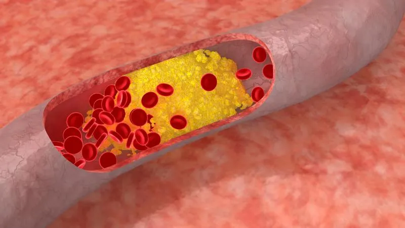 Hiểu rõ về Cholesterol toàn phần: Mảnh ghép quan trọng trong bức tranh sức khỏe