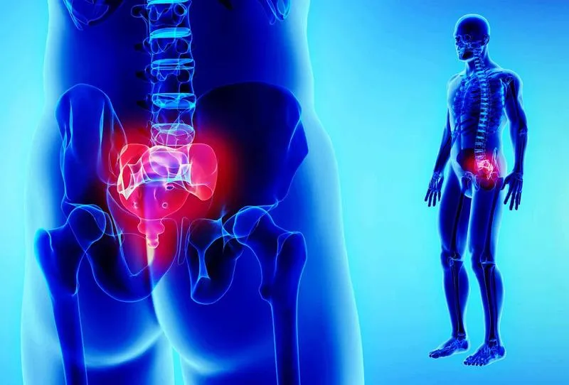 Hội chứng Piriformis: Nguyên nhân, dấu hiệu nhận biết và cách điều trị