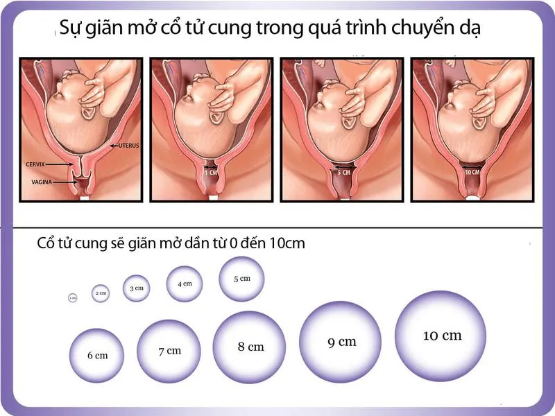 Khám xóa mở cổ tử cung là gì? Khám xoá mở cổ tử cung có ảnh hưởng gì không?