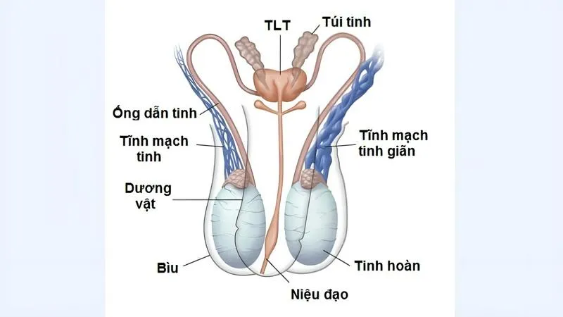 Khi nào cần điều trị giãn tĩnh mạch thừng tinh độ 1? Bệnh được điều trị như thế nào?