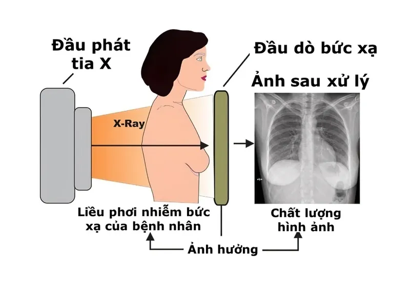 Mức độ phóng xạ khi chụp X quang có đủ để gây nguy hiểm không?