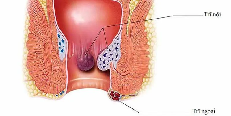 Ngứa hậu môn khám ở đâu là uy tín tại Thành phố Hồ Chí Minh?