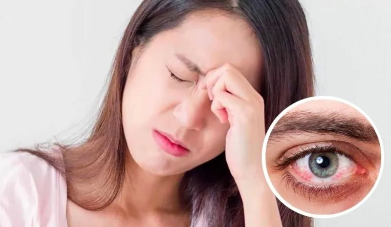 Người bị đau mắt đỏ kiêng quan hệ tình dục có cần thiết không?