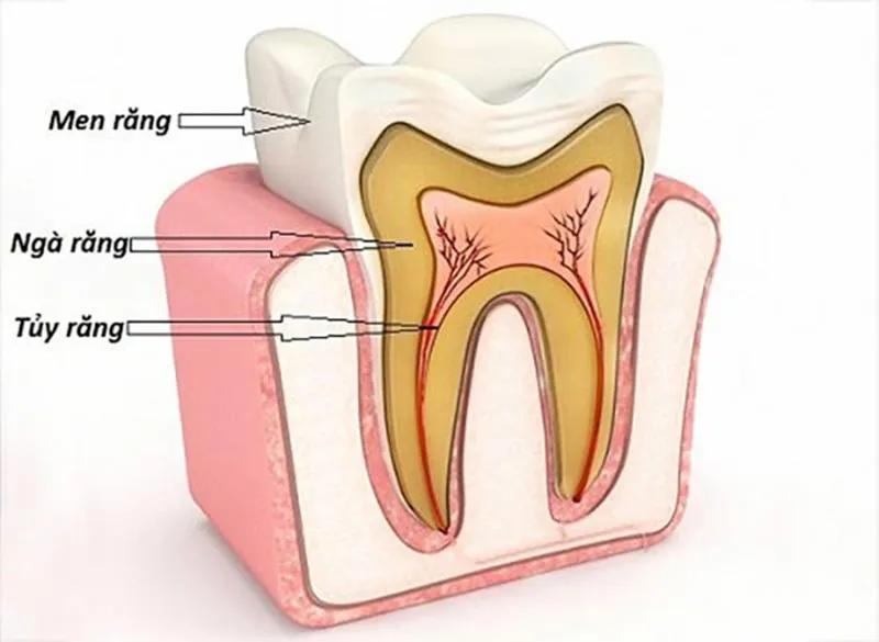 Nguyên nhân bị mẻ răng hàm là gì? Cách phục hồi đúng cách?