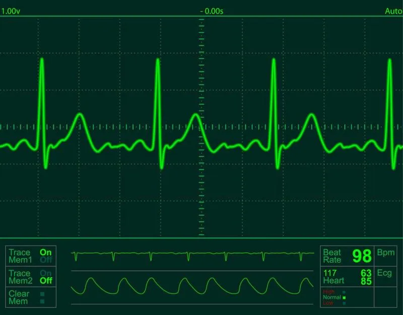 Những ai dễ bị nhồi máu cơ tim? Các phương pháp chẩn đoán bệnh