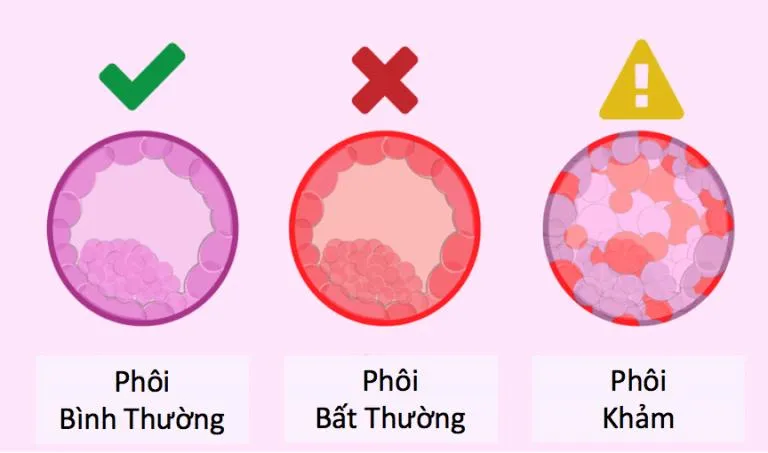 Phôi khảm là gì? Phôi khảm có chuyển được không?