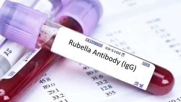 Rubella igG dương tính có ý nghĩa như thế nào?