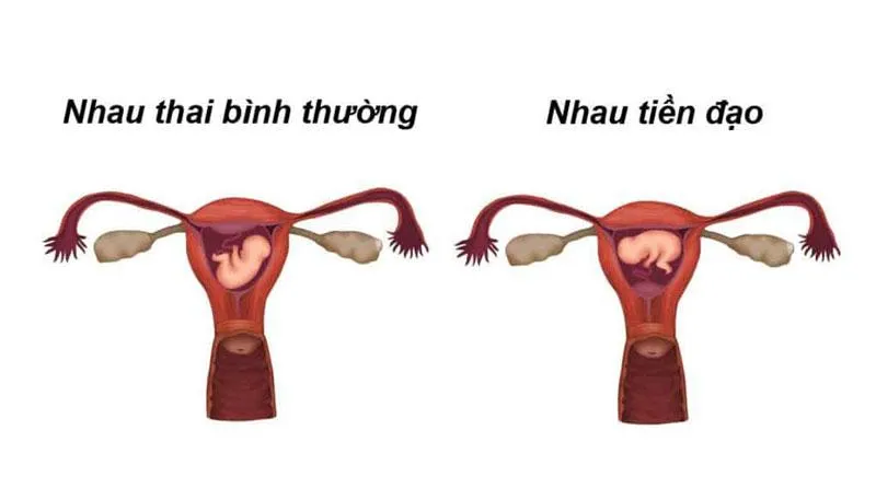 Siêu âm 2D có chính xác không? Những lưu ý khi thực hiện