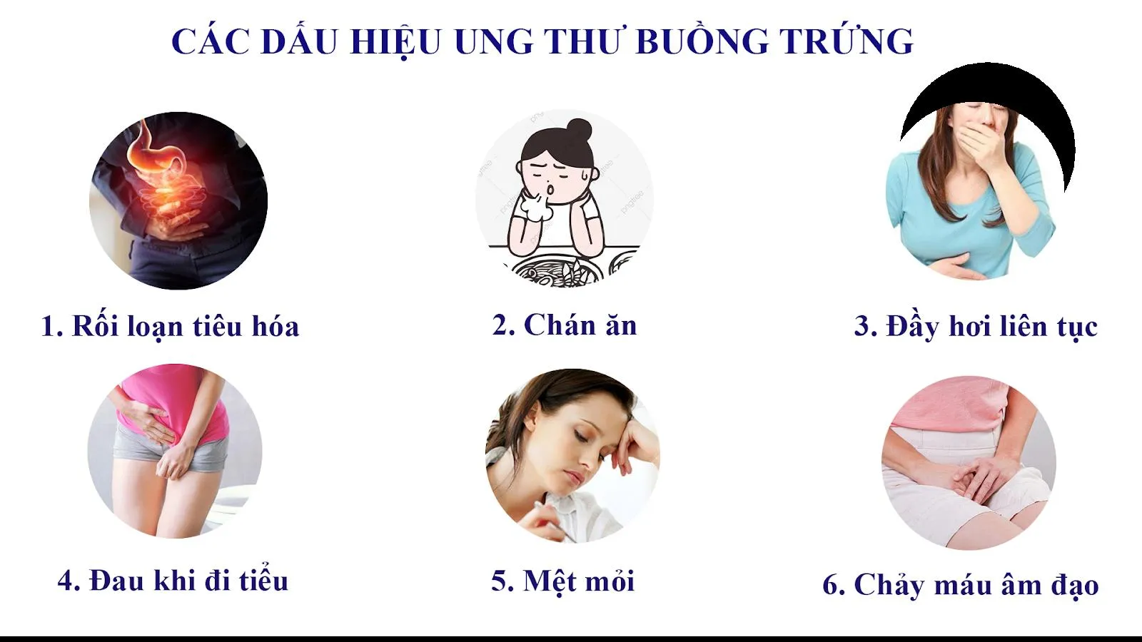 Siêu âm có phát hiện ung thư buồng trứng không?