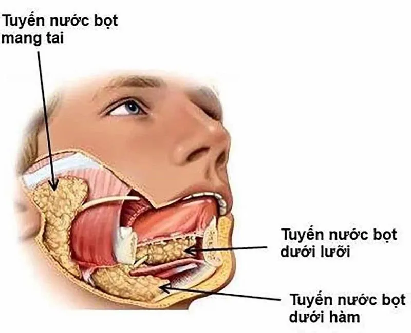 Sỏi tuyến nước bọt: Những thông tin quan trọng bạn cần biết