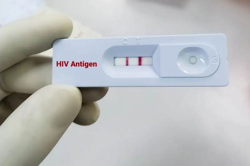 Thời gian xét nghiệm HIV cho kết quả chính xác nhất!