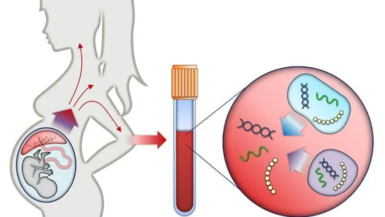 Thông tin về 2 phương pháp xét nghiệm NIPT và Double Test