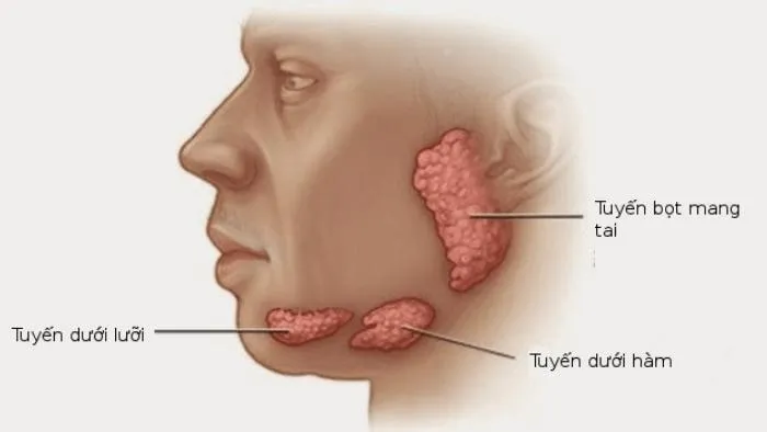 Thông tin về thủ thuật cắt tuyến dưới hàm