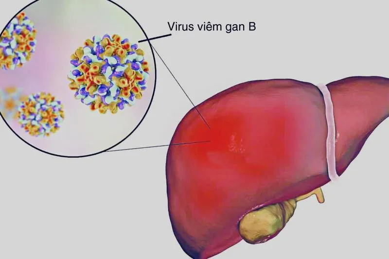 Vacxin Gene - HBvax (lọ 1 ml): Công dụng, thành phần và cách sử dụng