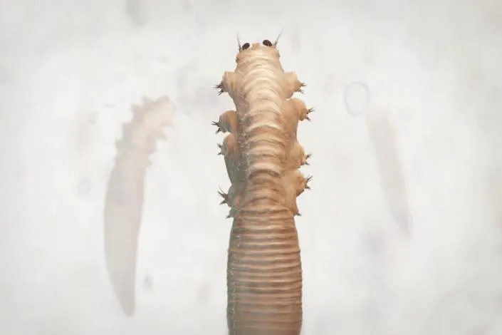 Viêm da do Demodex có triệu chứng gì? Cách điều trị và phòng bệnh