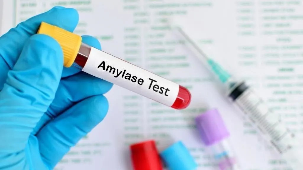 Xét nghiệm amylase là gì? Ý nghĩa của các giá trị nồng độ amylase