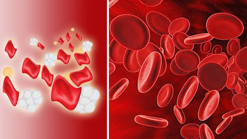 Xét nghiệm gen Thalassemia là gì? Những ai nên thực hiện xét nghiệm gen Thalassemia?