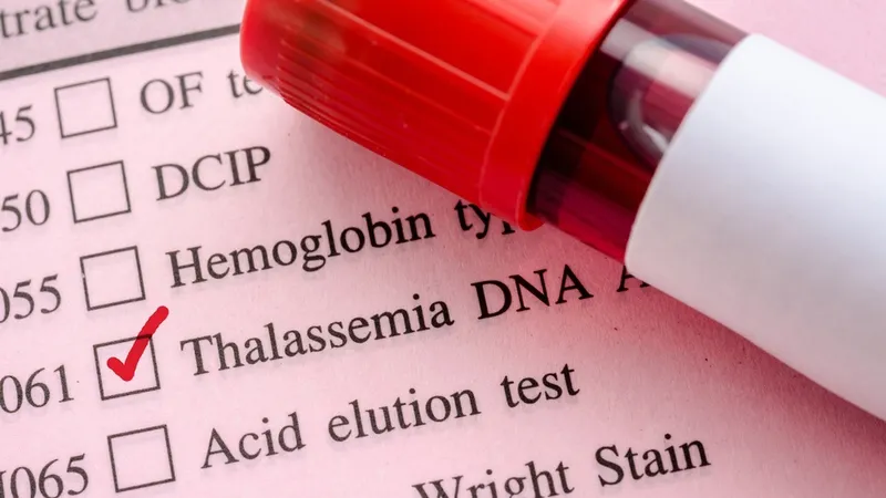 Xét nghiệm gen Thalassemia là gì? Những ai nên thực hiện xét nghiệm gen Thalassemia?