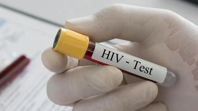 Xét nghiệm HIV có cần nhịn ăn không? Thông tin và lời khuyên hữu ích