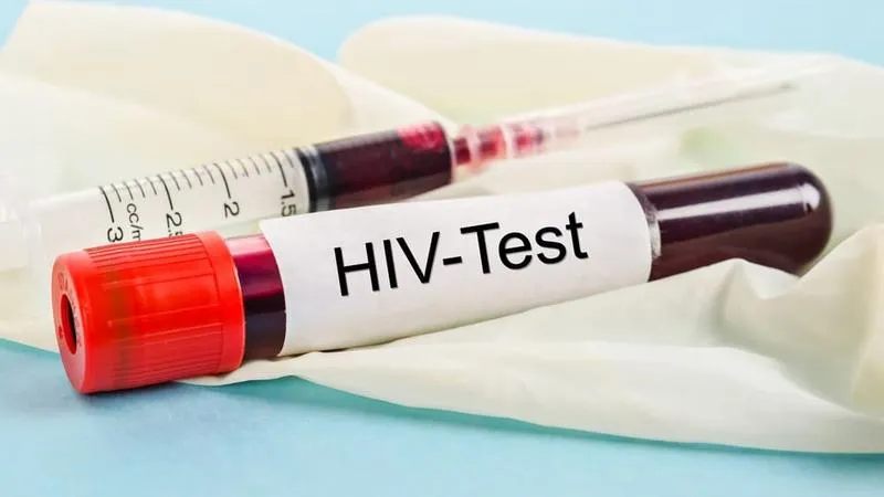 Xét nghiệm HIV khẳng định: Phương pháp xác định chính xác tình trạng nhiễm HIV