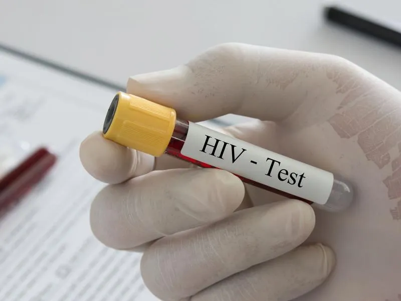 Xét nghiệm HIV khẳng định: Phương pháp xác định chính xác tình trạng nhiễm HIV