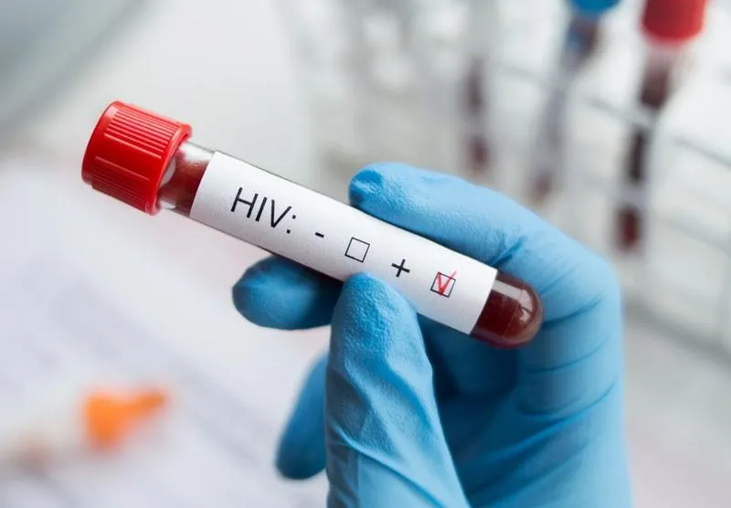 Xét nghiệm HIV khẳng định: Phương pháp xác định chính xác tình trạng nhiễm HIV