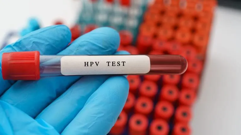 Xét nghiệm HPV bao nhiêu tiền? Quy trình như thế nào?