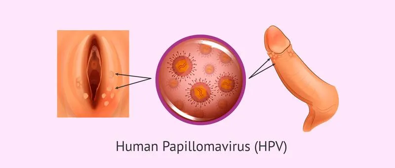 Xét nghiệm HPV dương tính: Ý nghĩa và những điều cần biết