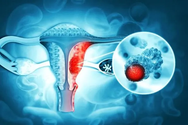 Xét nghiệm PCR là gì? Tại sao cần làm xét nghiệm PCR?