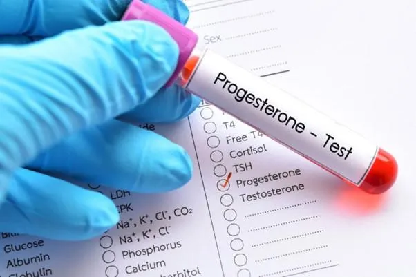 Xét nghiệm progesterone là gì? Tại sao cần làm xét nghiệm progesterone?