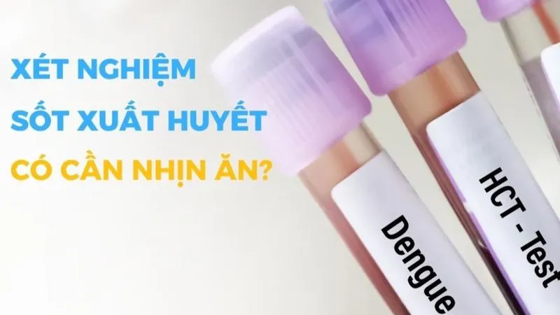 Xét nghiệm sốt xuất huyết có cần nhịn ăn không?