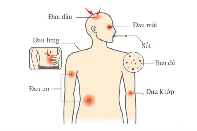 Xét nghiệm sốt xuất huyết ở đâu TP.HCM uy tín?