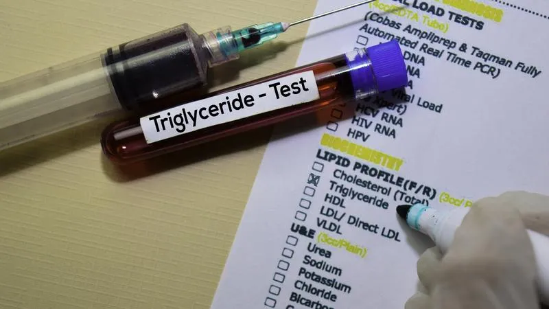 Xét nghiệm triglycerid để làm gì? Triglycerid như thế nào là an toàn?