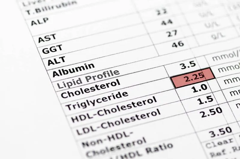 Xét nghiệm triglycerid để làm gì? Triglycerid như thế nào là an toàn?